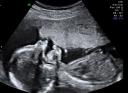 Big Sonogram picture 1