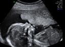 Big Sonogram 2