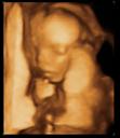 Big Sonogram 3
