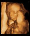 Big Sonogram 4