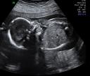 Big Sonogram 5
